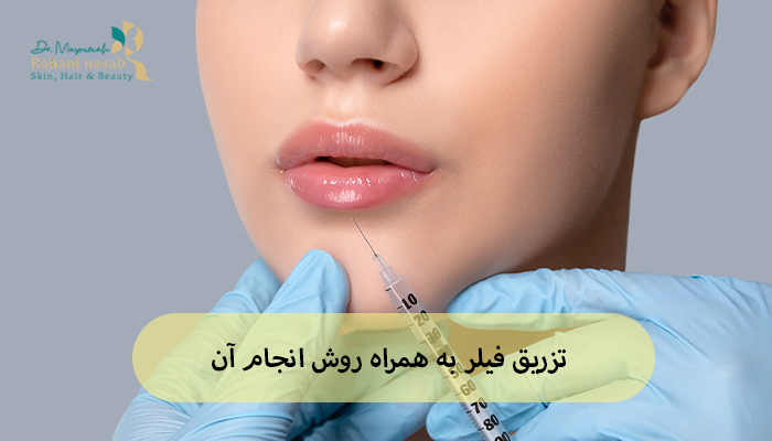 مراحل تزریق فیلر