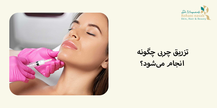 تزریق چربی چگونه انجام میشود؟