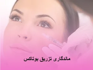 ماندگاری تزریق بوتاکس