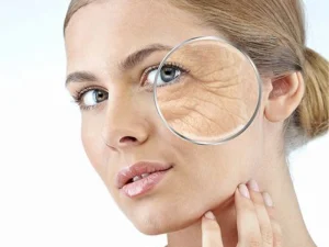 سن تزریق بوتاکس