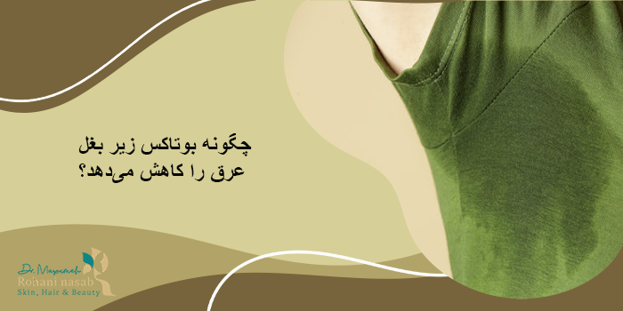 چگونه بوتاکس زیر بغل عرق را کاهش می‌دهد؟