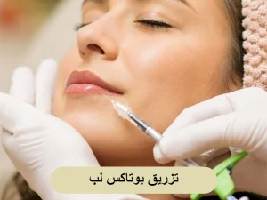 تزریق بوتاکس لب