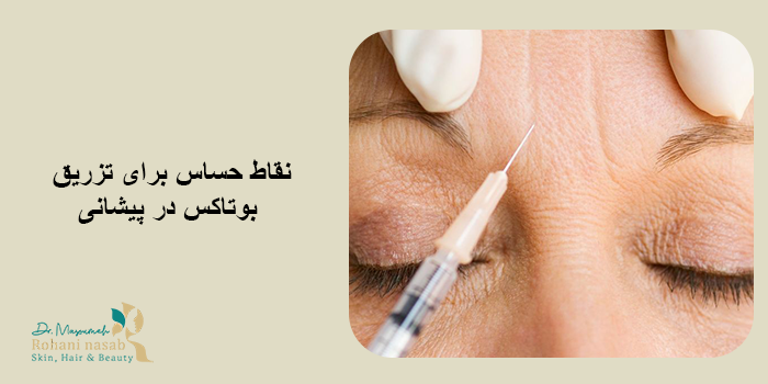 نکات مهم در انتخاب نقاط تزریق بوتاکس