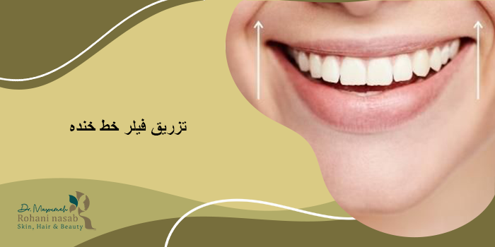 مزایای تزریق فیلر خط خنده