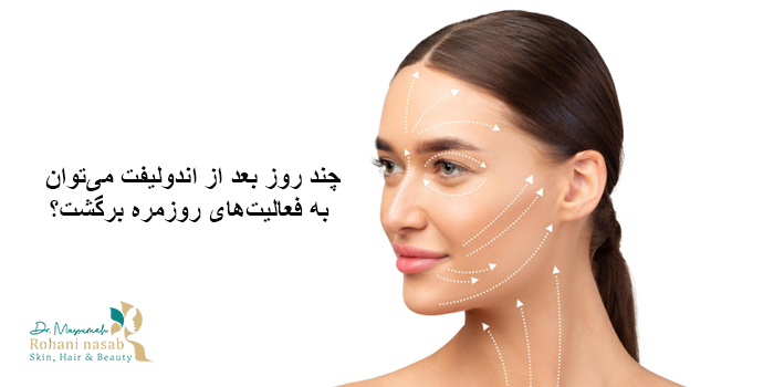 چند روز بعد از اندولیفت می‌توان به فعالیت‌های روزمره برگشت؟