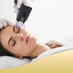 هزینه آر اف فرکشنال