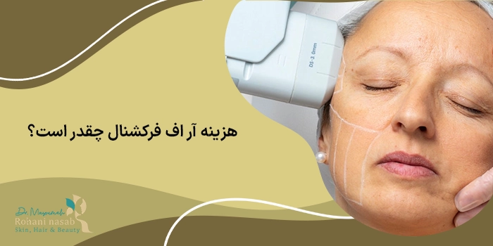 هزینه آر اف فرکشنال