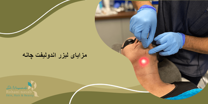 اندولیفت چانه