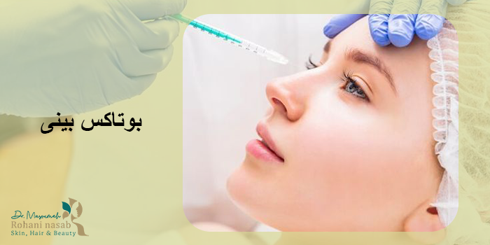 بوتاکس بینی