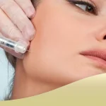 زاویه‌ سازی فک با تزریق بوتاکس