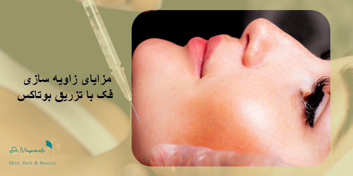 مزایای زاویه‌ سازی فک با تزریق بوتاکس