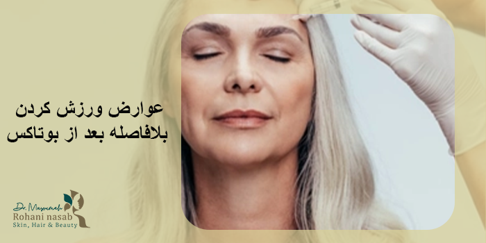 ورزش بعد از بوتاکس