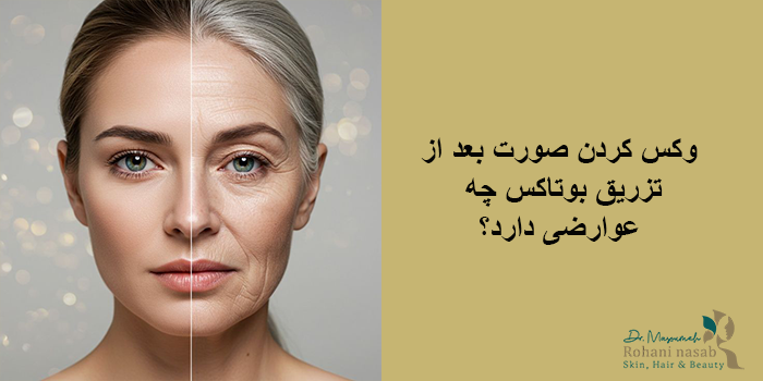 اصلاح صورت بعد از بوتاکس