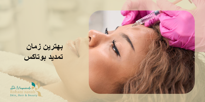 بهترین زمان تمدید بوتاکس
