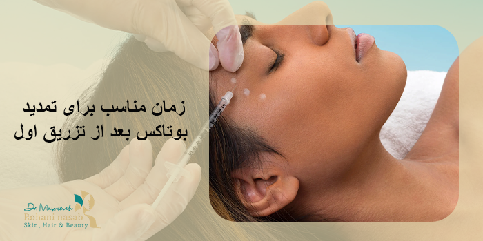 زمان مناسب برای تمدید بوتاکس بعد از تزریق اول