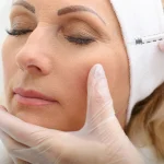 حالت تهوع بعد از بوتاکس
