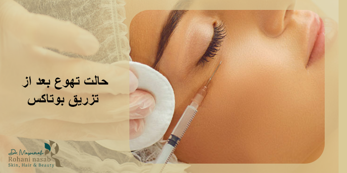 حالت تهوع بعد از بوتاکس