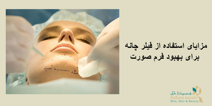 مدت زمان ماندگاری فیلر چانه چقدر است؟
