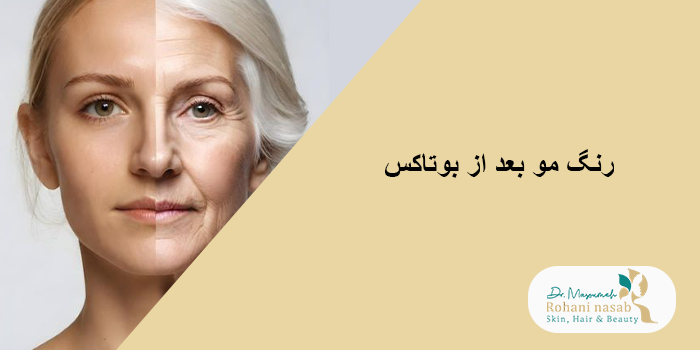 رنگ مو بعد از بوتاکس