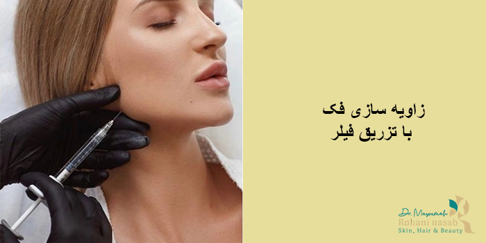 فیلر زاویه فک