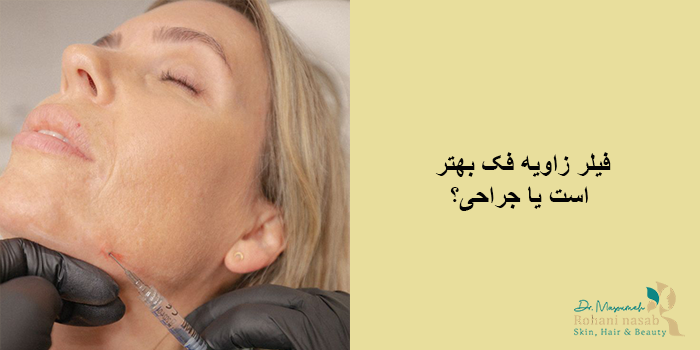 فیلر زاویه فک بهتر است یا جراحی؟