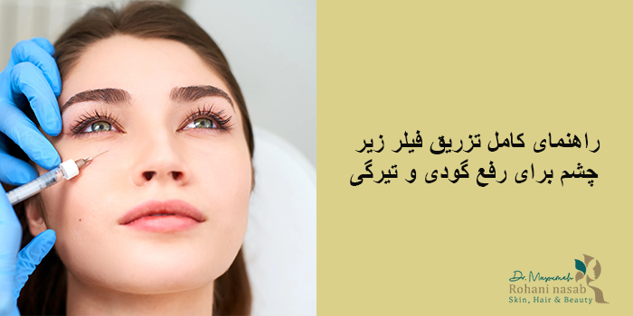 راهنمای کامل تزریق فیلر زیر چشم برای رفع گودی و تیرگی