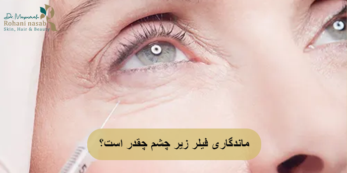 ماندگاری فیلر زیر چشم چقدر است؟