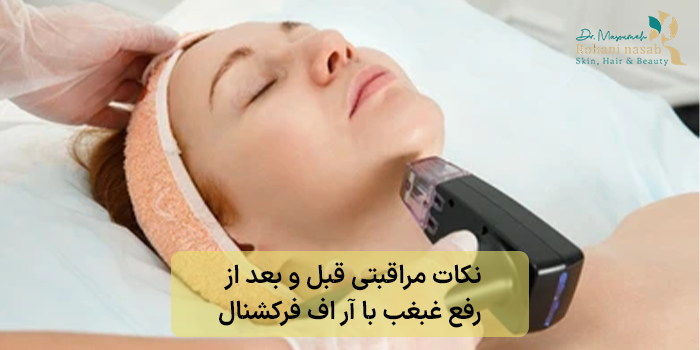 نکات مراقبتی قبل و بعد از رفع غبغب با آر اف فرکشنال