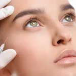 آرایش بعد از بوتاکس