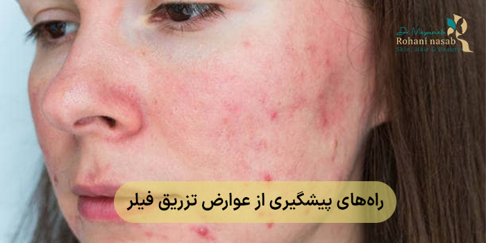 راه‌های پیشگیری از عوارض تزریق فیلر