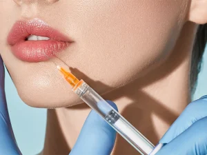 تزریق فیلر لب