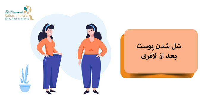شل شدن پوست بعد از لاغری