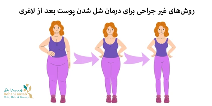 روشهای غیر جراحی برای درمان شل شدن پوست بعد از لاغری