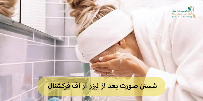 شستن صورت بعد از لیزر آر اف فرکشنال